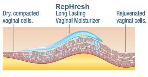 Gel Rephresh khắc phục chứng bệnh khô rát âm đạo